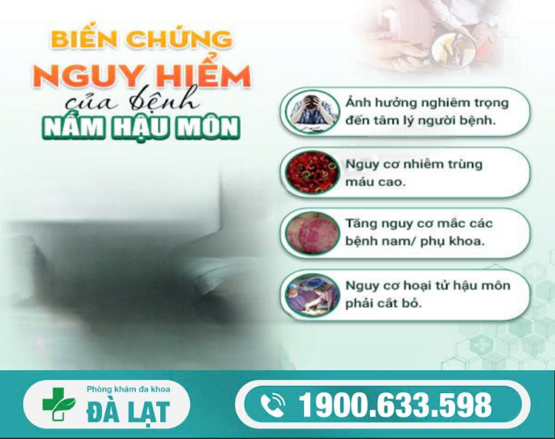 Hình ảnh minh họa